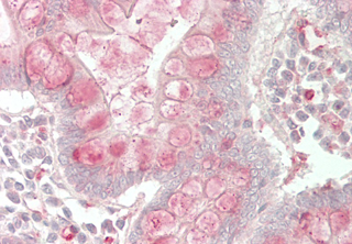 Immunohistochemical staining of CTRP7 using anti-CTRP7 (GD) (human), pAb (Prod. No. AG-25A-0097) in human small intestine tissue (5?g/ml). This antibody has been tested in immunohistochemistry, analyzed by an anatomic pathologist and validated