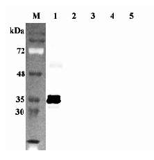 Western blot analysis using anti-Sirtuin 5 (human), pAb (Prod. No. AG-25A-0100) at 1:2'000 dilution.
1: Human Sirtuin 5 (intact form) (His-tagged).
2: Human Sirtuin 1 (His-tagged).
3: Human Sirtuin 2 (His-tagged).
4: Human Sirtuin