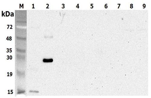 Western blot analysis using anti-CTRP5 (human), pAb (Prod. No. AG-25A-0103) at 1:5'000 dilution.
1: Human CTRP5 (tGD) (His-tagged).
2: Human CTRP5 (His-tagged).
3: Human CTRP5 (GD) (His-tagged) (negative control).
4: Human CTRP6 (H