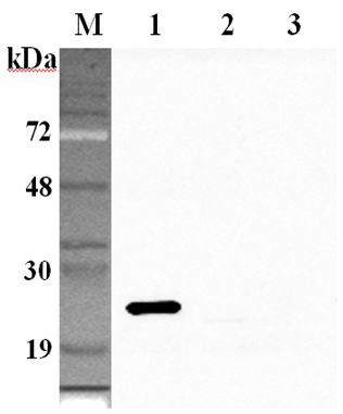 Western blot analysis using anti-GPX1 (human), pAb (Prod. No. AG-25A-0104) at 1:2'000 dilution.
1: Human GPX1 (His-tagged).
2: Human GPX2 (His-tagged).
3: Human GPX3 (His-tagged).