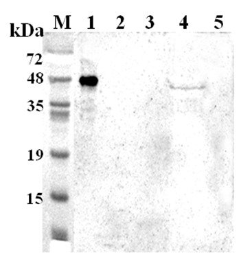 Western blot analysis using anti-TDO (human), pAb (Prod. No. AG-25A-0106) at 1:2'000 dilution.
1: Human TDO (His-tagged).
2: Human IDO (His-tagged).
3: Mouse IDO (His-tagged).
4: SH-sy5y cell lysate.
5: Unrelated protein (His