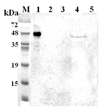 Western blot analysis using anti-TDO (human), pAb (Prod. No. AG-25A-0106) at 1:2000 dilution. 1: Human TDO (His-tagged). 2: Human IDO (His-tagged). 3: Mouse IDO (His-tagged). 4: SH-sy5y cell lysate. 5: Unrelated protein (His