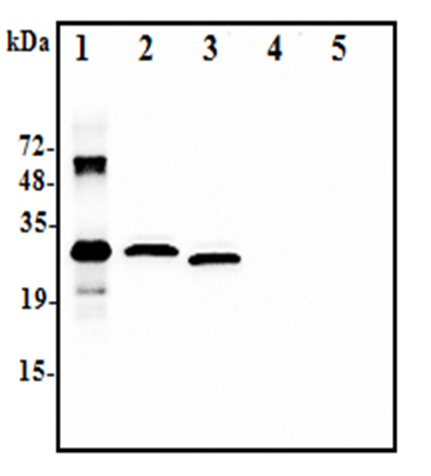 Western blot analysis using anti-IL-37 (human), pAb (Prod. No. AG-25A-0111) at 1:2.000 dilution:1. Recombinant human IL-37-His (50ng)2. Human IL-37-FLAG transfected HEK293 cell lysate(100?g)3. Human IL-37-tag free transfecte