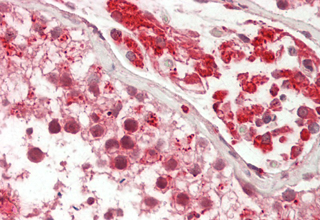 Immunohistochemical staining of CTRP1 using anti-CTRP1 (human), pAb (Prod. No. AG-25A-0114) in human testis tissue (15?g/ml). This antibody has been tested in immunohistochemistry, analyzed by an anatomic pathologist and validated for use in I