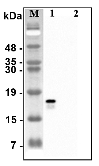 Western blot analysis of recombinant human CTRPs using anti-CTRP2 (human), pAb (Prod. No. AG-25A-0115) at 1:4,000 dilution.1: Recombinant human CTRP2 protein (His-tagged).2: Unrelated recombinant protein (His-tagged).