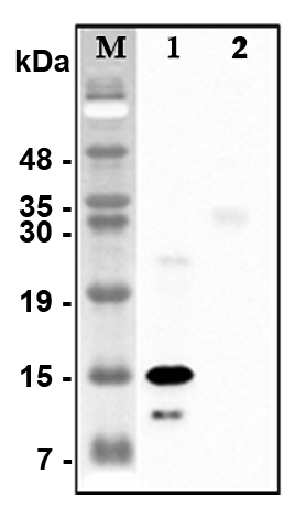 Western blot analysis of recombinant human CTRPs using anti-CTRP5 (human), pAb (Prod. No. AG-25A-0116) at 1:4,000 dilution.1: Recombinant human CTRP5 protein (His-tagged).2: Unrelated recombinant protein (His-tagged).