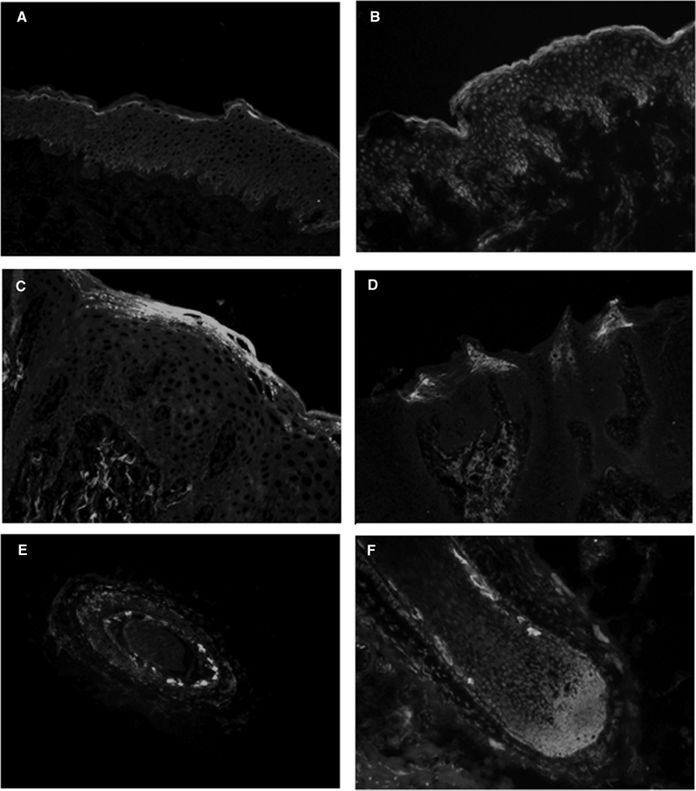 Immunohistochemical staining of repetin using anti-Repetin, pAb (AF646) (Prod. No. AG-25B-0017) and FITC-labeled anti-rabbit IgG antibody on frozen section of human skin (A), human foreskin (B), human tongue (C and D) and human hair follicles (E and F).