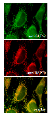 Endogenous SLP-2 is localized to the mitochondria (Immunocytochemical staining).  Endogenous SLP-2 (green) (up) and endogenous mitochondrial HSP70 (red) (middle) were detected in methanol fixed HeLa cells using anti-SLP-2, pAb (Prod. No. AG-20B-0019