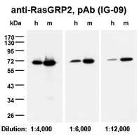 Western Blot on human (h) and mouse (m) platelets samples (5?g protein each per lane) using anti-RasGRP2, pAb (IG-09) (AG-25T-0118), diluted as indicated in TBS/Tween (0.1%) with 5% milk.