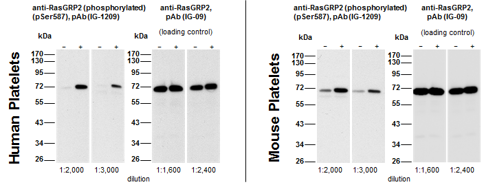 Western blot: Human (5?g protein/lane) and mouse (8?g protein/lane) platelets were either not stimulated (-) or were incubated with 5?M Forskolin for 1 min (+). Western blots at the indicated dilutions were performed using anti-RasGRP2 (phosphorylated) (p