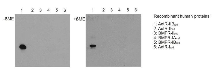 Western blot with extracellular domains (ecd) of different related human receptors (50ng per lane) reveals that anti-Activin Receptor IIB, pAb (IG-510) (Prod. No. AG-25T-0114) (dilution 1:5000) specifically recoginzes ACTR-IIB under nonreducing (-?ME, lef