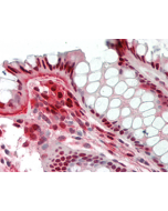 Immunohistochemical staining of Nampt using anti-Nampt (Visfatin/PBEF), mAb (OMNI379) (Prod. No. AG-20A-0034B) in formalin-fixed and paraffin-embedded (FFPE) human colon tissue (15µg/ml).