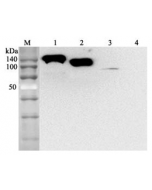Western blot analysis using anti-ACE2 (human), mAb (AC384) (Prod. No. AG-20A-0037) at 1:2'000 dilution.1: Human ACE2 Fc-fusion protein.2: Human ACE2 (Ecto domain) (FLAG®-tagged). 3: HepG2 cell lysate.4: Other Fc-fusion (