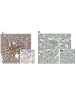 Immunohistochemical staining of human tissue using anti-ANGPTL4 (human), mAb (Kairos-1) (Prod. No. AG-20A-0038) at 1:500 dilution.A. Immunoperoxidase staining of formalin-fixed, paraffin-embedded human spleen (200x).A-1. Isotype control (negat