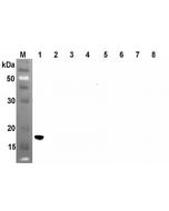 Western blot analysis using anti-ANGPTL4 (CCD) (human), mAb (Kairos4-153AD) (Prod. No. AG-20A-0046) at 1:500 dilution.1: Human ANGPTL4 (CCD) (FLAG®-tagged).2: Human ANGPTL4 (FLD) (FLAG®-tagged).3: Human ANGPTL4 (FLA