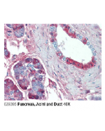 Immunohistochemical staining of JAG1 using anti-Jagged-1 (human), mAb (J1G53-3) (Prod. No. AG-20A-0049) in Pancreas, Acini and Duct (2.5 μg/ml).This antibody has been tested in immunohistochemistry, analyzed by an anatomic pathologist and validat