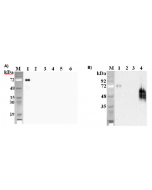 Western blot analysis using anti-DLK1 (mouse), mAb (PF105B) (Prod. No. AG-20A-0057) at 1:2'000 dilution.A)1: Mouse DLK1 Fc-protein.2: Human DLK1 Fc-protein.3: Mouse DLL1 Fc-protein.4: Mouse DLL4 Fc protein.5: Mouse Jagg