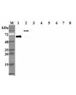 Western blot analysis using anti-DLL1 (human), mAb (D1L165-6) (Prod. No. AG-20A-0074) at 1:2'000 dilution.1: Human DLL1 (FLAG®-tagged).2: Human DLL1 Fc-protein.3: Human DLL3 Fc-protein.4: Human DLL4 Fc-protein.5: H