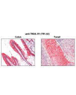 Immunohistochemistry detection of endogenous TRAIL-R1 in paraffin-embedded human carcinoma tissues (colon, tonsil) using mAb to TRAIL-R1 (TR1.02) (Prod. No. AG-20B-0027).