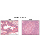 Immunohistochemistry detection of endogenous TRAIL-R2 in paraffin-embedded human carcinoma tissues (colon, tonsil) using mAb to TRAIL-R2 (TR2.21) (Prod. No. AG-20B-0028).