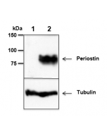 Mouse Periostin is detected by immunoblotting using anti-Periostin, mAb (Stiny-1) (Prod. No AG-20B-0033).
Whole tissue extracts from mouse liver (lane 1) or mammary tumor (lane 2) were separated by SDS-PAGE under reducing conditions, transferred to 