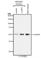 Western blot analysis of protein acetylation with anti-α-Tubulin (acetylated), mAb (TEU318) (Prod. No. AG-20B-0068).Method: HEK-293T cells grown in standard culture conditions, transfected with plasmids expressing the tubulin acetyl tra