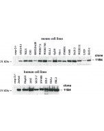 Western blot analysis using anti-caspase-2, mAb (11B4) (Prod. No. AG-20T-0136), detecting caspase-2 expression in cultured mouse and human cell lines. Caspase-2 protein was revealed in lysates from 2x105 mouse and human cell lines by 11B4 and E