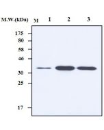 Western blot analysis using anti-HES1, mAb (7H11) (Prod. No. AG-20T-0400) in cell lysates. Lane1: HeLa cell lysate; Lane 2: HT29 cell lysate; Lane 3: BeWo cell lysate.