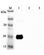 Western blot analysis using anti-IL-33 (mouse), pAb (Prod. No. AG-25A-0047) at 1:2'000 dilution.
1: Mouse IL-33 (His-tagged).
2: Human IL-33 (His-tagged).
3: Unrelated protein (His-tagged) (negative control).