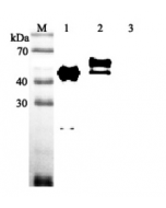 Western blot analysis using anti-Vaspin (human), pAb (Prod. No. AG-25A-0048) at 1:2'000 dilution.
1: Human Vaspin (His-tagged).
2: Human Vaspin (FLAG®-tagged).
3: Mouse IL-33 (His-tagged) (negative control).