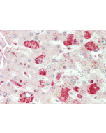 Immunohistochemical staining of ANGPTL3 using anti-ANGPTL3 (CCD) (human), pAb (Prod. No. AG-25A-0060) in human liver tissue (5µg/ml). This antibody has been tested in immunohistochemistry, analyzed by an anatomic pathologist and validated for 