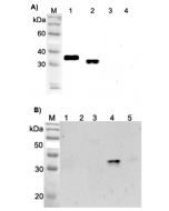 Western blot analysis using anti-ANGPTL4 (FLD) (human), pAb (Prod. No. AG-25A-0065) at 1:2'000 dilution.
A)
1: Human ANGPTL4 (FLD) (FLAG®-tagged).
2: Human ANGPTL4 (FLAG®-tagged).
3: Human ANGPTL4 (CCD) (FLAG