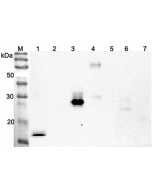 Western blot analysis using anti-ANGPTL4 (CCD) (human), pAb (Prod. No. AG-25A-0066) at 1:2'000 dilution.
1: Human ANGPTL4 (CDD) (FLAG®-tagged).
2: Human ANGPTL4 (FLAG®-tagged).
3: Human ANGPTL3 (CCD) (FLAG®
