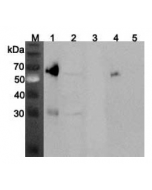 Western blot analysis using anti-ANGPTL3 (mouse), pAb (Prod. No. AG-25A-0070) at 1:2'000 dilution.
1: Mouse ANGPTL3 (FLAG®-tagged) (40ng).
2: Mouse liver cell lysate (Balb/c mouse, 150μg).
3: Mouse ANGPTL4 (FLAG®
