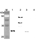 Western blot analysis of human FGF21 using anti-FGF-21 (human), pAb (Prod. No. AG-25A-0074) at 1:4,000 dilution.. 1. Recombinant human FGF21 (FLAG-tagged). 2. Recombinant human FGF21 (Fc protein). 3. Recombinant human FGF21 (His-tagged).