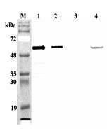 Western blot analysis of mouse FTO using anti-FTO (mouse), pAb (Prod. No. AG-25A-0089) at 1:4,000 dilution. 1. Recombinant mouse FTO (His-tagged) (100ng). 2. Recombinant human FTO (His-tagged) (100ng). 3. Recombinant hFGF19 (His-tagged) 