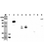 Western blot analysis using anti-ANGPTL7 (CCD) (human), pAb (Prod. No. AG-25A-0095) at 1:2'000 dilution.
1: Human ANGPTL7 (CCD) (FLAG®-tagged).
2: Human ANGPTL7 (FLAG®-tagged).
3: Human ANGPTL7 (FLD) (FLAG®