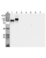 Western blot analysis using anti-DNER (human), pAb (Prod. No. AG-25A-0102) at 1:4'000 dilution.
1: Human DNER (ED) (FLAG®-tagged).
2: Human DNER (ED) Fc-protein.
3: Human DLL1 (His-tagged).
4: Human DLL4 (His-tagged).