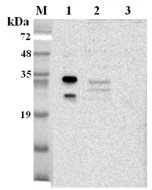 Western blot analysis using anti-NQO1 (human), pAb (Prod. No. AG-25A-0105) at 1:2'000 dilution.
1: Human NQO1 (His-tagged).
2: HepG2 cell lysate.
3: Unrelated protein (His-tagged) (negative control).