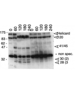 Western blot analysis anti-MDA5 (mouse), pAb (AL180) (Prod. No. AG-25B-0001) detecting the cleavage of endogenous mouse MDA5 as an indicator of apoptosis. Method: Cleavage of endogenous Helicard in murine A20 B lymphomas undergoing Fas-mediated apo