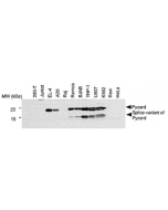 Western blot analysis of human and mouse cell lines using anti-Asc, pAb (AL177) (Prod. No. AG-25B-0006). 
Total protein extracts from various human (293-T, Jurkat, Raj, Ramos, BJAB, THP-1, U937, K562, Raw, HeLa) and mouse (EL-4, A20) cell lines were