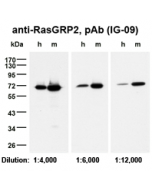 Western Blot on human (h) and mouse (m) platelets samples (5μg protein each per lane) using anti-RasGRP2, pAb (IG-09) (AG-25T-0118), diluted as indicated in TBS/Tween (0.1%) with 5% milk.