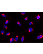 Rab6-GTP is detected by immunocytochemistry using anti-Rab6-GTP, mAb (AA2) (Prod. No. AG-27B-0004). Method: HeLa cells are grown in standard culture conditions, fixed with paraformaldehyde (3%), permeablized in  PBS+ BSA 0.2 % + Sap