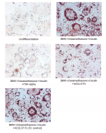 Adipogenesis inhibition of 3T3L1 cells. 3T3L1 cells were maintained in DMEM, supplemented with 10% fetal bovine serum, penicilin-streptomycin. Adipogenesis was initiated by adding 1μM Dexamethasone, 0.5mM IBMX, 10μg/m lnsulin (day 0) until day