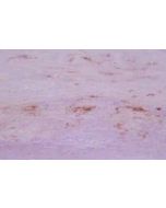 Immunohistochemical staining of 7KC in atherosclerotic aorta using anti-7-KC, mAb (35A).