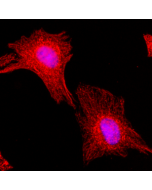 Immunocytochemical staining of HeLa cells, using Anti-α-Tubulin RevMAb Clone RM113 at 1/200 dilution (red). Nuclei have been labeled with DAPI (blue).