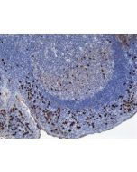 Immunohistochemistry of Human Lymphoid Tissue using anti-Human IgA antibody RM128.