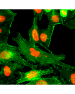 Immunocytochemical staining of HeLa cells treated with sodium butyrate, using anti-Monomethyl-Histone H4 (Arg3) Rabbit Monoclonal Antibody (clone RM195) (red). Actin filaments have been labeled with fluorescein phalloidin (green).