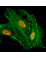 Immunocytochemical staining of HeLa cells treated with sodium butyrate, using anti-Acetyl-Histone H4 (Lys8) Rabbit Monoclonal Antibody (clone RM201) (red). Actin filaments have been labeled with fluorescein phalloidin (green).