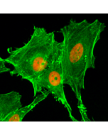 Immunocytochemical staining of HeLa cells treated with sodium butyrate, using anti-Acetyl-Histone H4 (Lys20) Rabbit Monoclonal Antibody (clone RM205) (red). Actin filaments have been labeled with fluorescein phalloidin (green).
